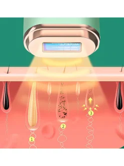 DAM Technik|Pflege & Gesundheit<IPL-Haarentferner in Grün